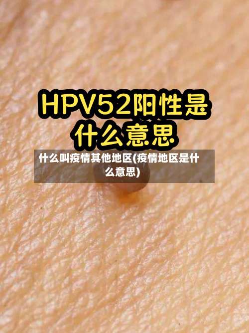 什么叫疫情其他地区(疫情地区是什么意思)-第3张图片